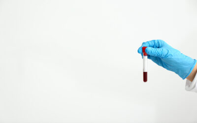 ARSIA – comment ses agents gèrent l’épidémie FCO ?